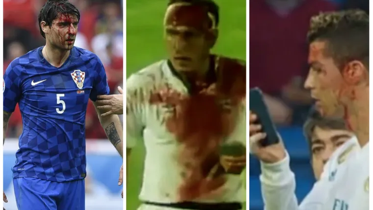 Nema sumnje da je Portugalca boljelo, no možda nije vidio kako se s time nose veliki dečki