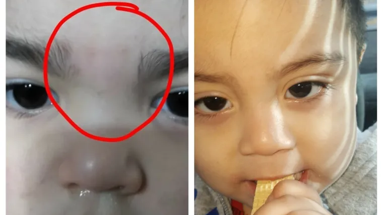 Nevjerojatno: dvogodi&scaron;njoj djevojčici u jaslicama voskom depilirali obrve, javila se i majka jednogodi&scaron;njeg dječaka