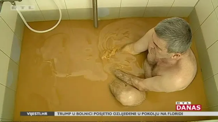 Specijalna bolnica u kojoj se oboljeli od psorijaze liječe naftalanom