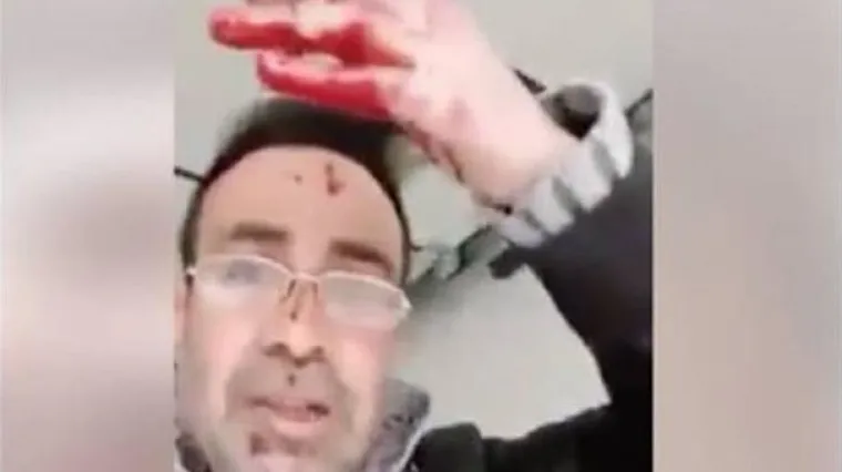 Nasmrt izbo suprugu pa krvav pokrenuo Facebook uživo: 'Ovako ćete sve zavr&scaron;iti'