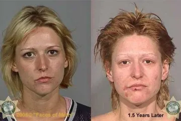 DROGA MOŽE POTPUNO IZOBLIČITI LJUDE U SAMO PAR MJESECI: Policija objavila fotografije kako bi upozorila ljude na opasnu drogu