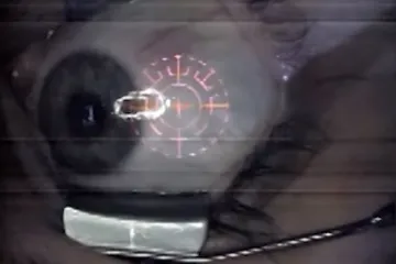 Doktor kirurškim putem usadio nakit u očnu jabučicu žene