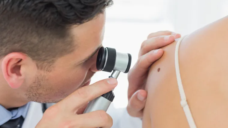 U Hrvatskoj od melanoma če&scaron;će obolijevaju mu&scaron;karci - iskoristite priliku i besplatno pregledajte madeže