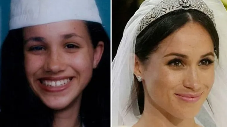 Žene žele njezin savr&scaron;en nos, ali stare fotke sugeriraju da ga je i ona sama 'sredila'