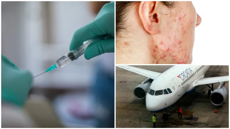 UČAJ OSPICA? U Zadru hospitaliziran mladić iz Srbije za kojeg se sumnja da ima ovu opaku bolest