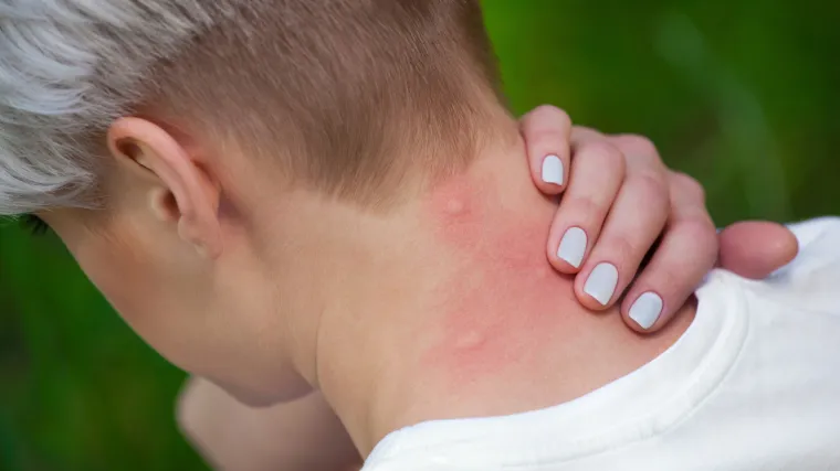 U borbi protiv komaraca pomoć traže od Plenkovića: ovoj županiji prijeti najezda