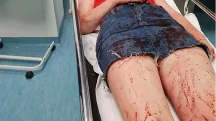 Zašto je Daruvarac koji je izmlatio djevojku uhićen tek nakon 12 sati? Policija u Zadar poslala unutarnju kontrolu!