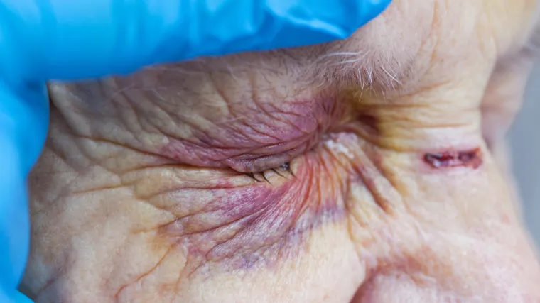 Oborio vlastitu majku na pod, a zatim je bjesomučno cipelario: Sud ga izbacio iz kuće