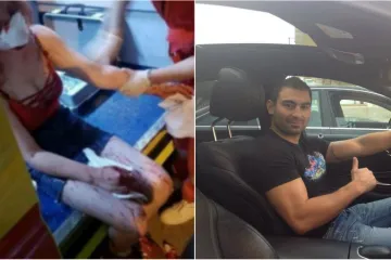 Unutarnja kontrola otkrila propuste u slučaju pretučene djevojke!