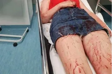 Ispravak objavljene informacije u tekstu: 'Majka pretučene djevojke u Zadru: Šef kafića pokušao je sve zataškati jer je dobar s policijom'