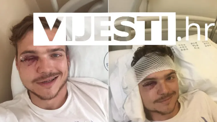 Satima su se borili da mu spase oko i rekonstruiraju kosti: 'Ne dopustimo jo&scaron; jedan slučaj Luke Ritza'