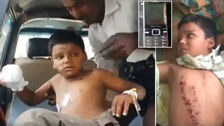 VIDEO Dječaku (8) eksplodirao mobitel u ruci: Ostao bez tri prsta