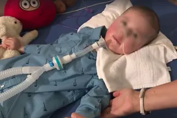 Moguće su ozbiljne nuspojave kod djece koja uzimaju taj lijek