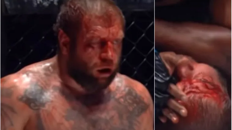 Brutalno ga izudarao laktovima