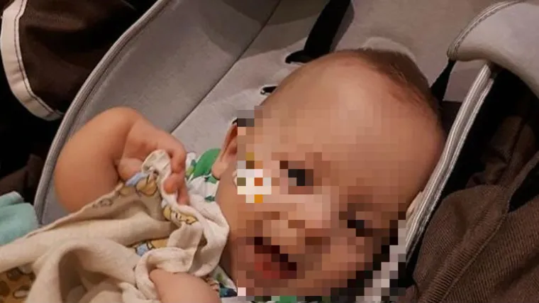 10-mjesečni dječak s te&scaron;kom bolesti nije dočekao operaciju u SAD-u