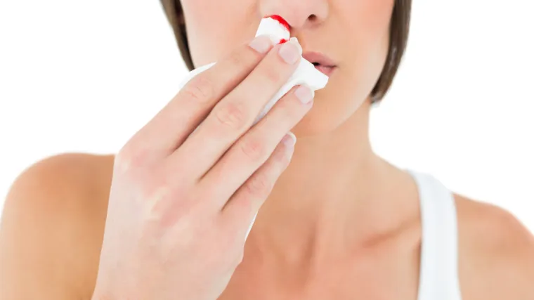 Za&scaron;to dolazi do krvarenja iz nosa i kako ga zaustaviti?