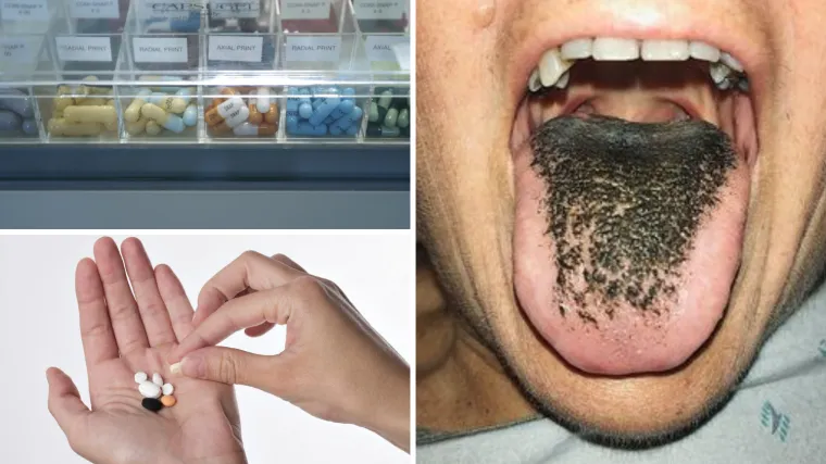 Dlakavi jezik, krvarenja, proljev: Hrvati su ludi za lijekovima bez recepta - zbog nuspojava umrlo 158 ljudi