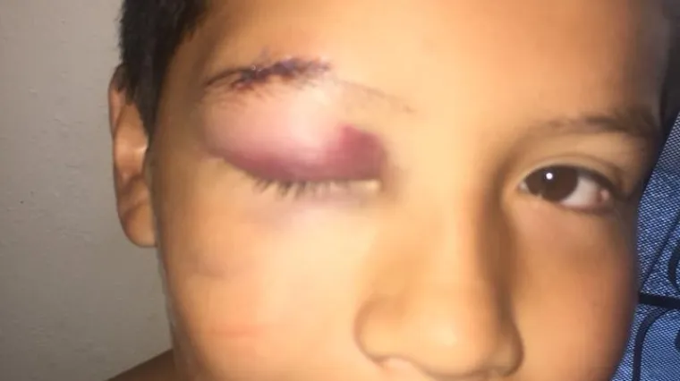 U &scaron;koli ga zlostavljaju tri godine, a on ne želi vratiti jer to 'nije Jedi način'