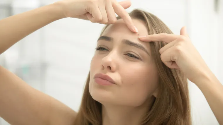 Prema položaju akni otkrijte s kojim se problemima vaše tijelo suočava