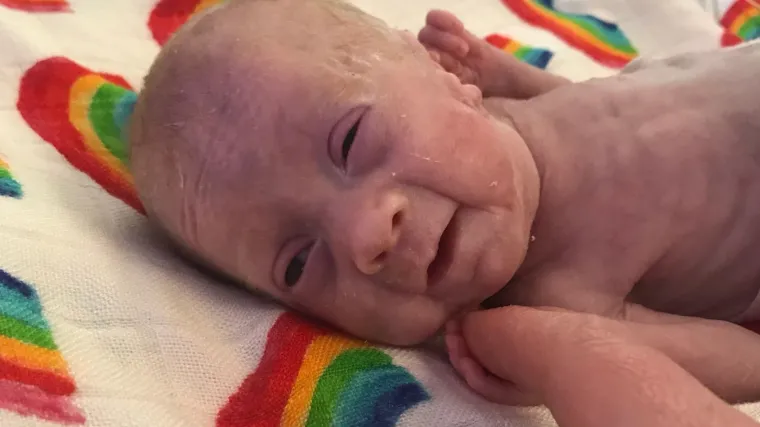 Beba kojoj nisu davali nikakve &scaron;anse za život posramila liječnike: 'Dogodilo se čudo'