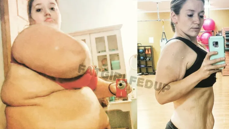 Djevojka smr&scaron;avjela 140 kilograma pa oti&scaron;la pod nož