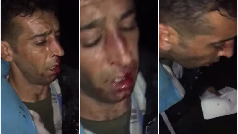 Hrvatski policajci na granici brutalno pretukli migrante?