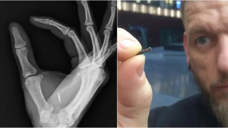 Možete si ugraditi čip u ruku kao zamjenu za sve kartice koji će uskoro sadržavati i GPS lokator