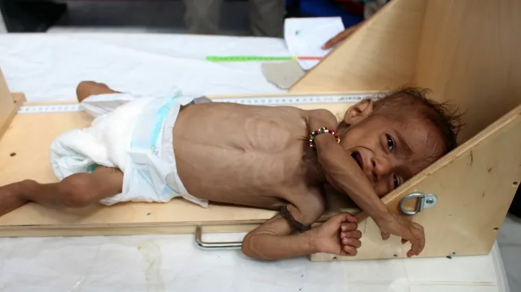 Gotovo 85.000 djece umrlo od gladi ili bolesti nakon intenziviranja rata