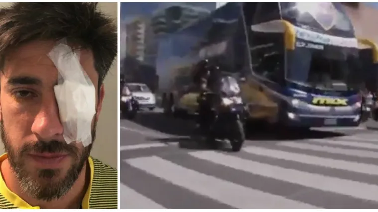 Finale između Boce i Rivera ponovno odgođeno: 'Ne želimo slu&scaron;ati izgovore, neka se igrači oporave'