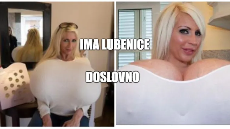 Ona ima najveće grudi na svijetu: Te&scaron;ke su 18 kilograma, od njih skoro ni&scaron;ta ne vidi, ali se osjeća korisno!