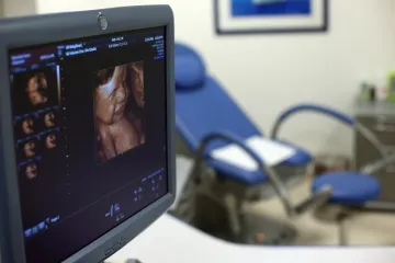 'Ovo potvrđuje da su razmjeri problema golemi'