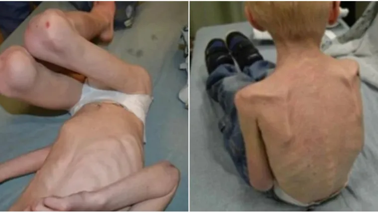 Maćeha iz pakla: Jordan je imao samo 13 kg, dobivao je koricu kruha dnevno; 'Umro bi za par dana'