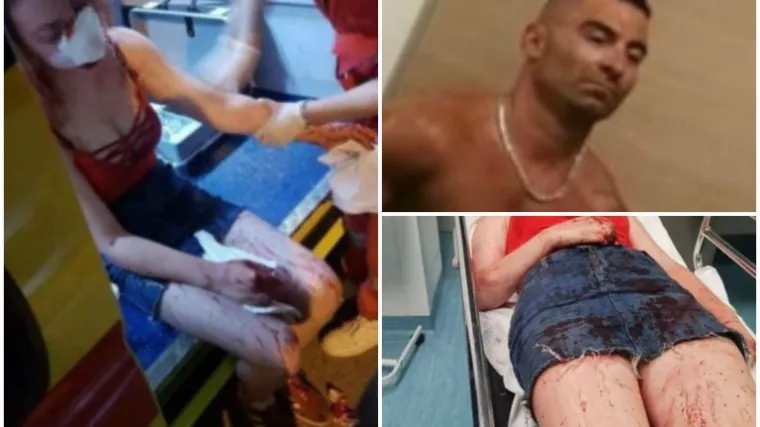 Progovorila žena koja je vidjela premlaćivanje 18-godi&scaron;njakinje u Zadru