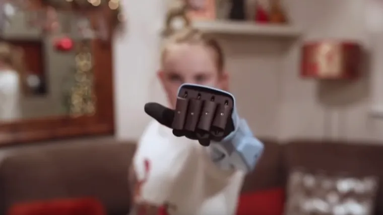 Anonimni donator curici poklonio bioničku ruku: 'Sad mogu raditi stvari s kojima sam se mučila'