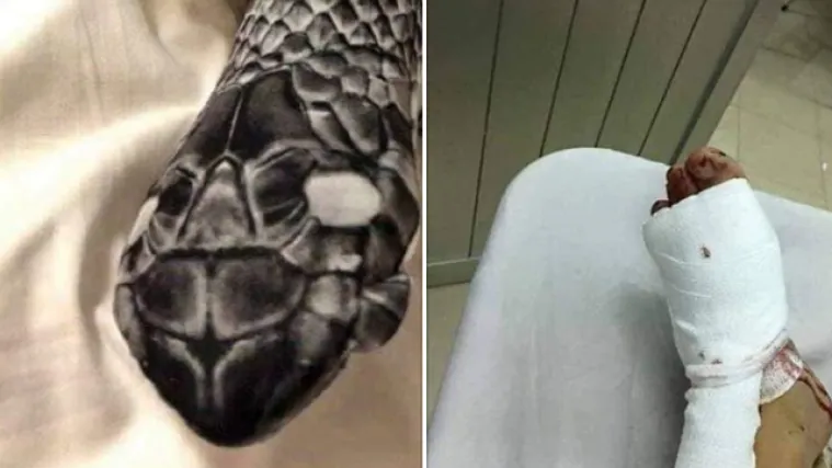 Zavr&scaron;ila u bolnici: mislio da su ženine noge u zmijskim tajicama prave zmije i poku&scaron;ao ih ubiti