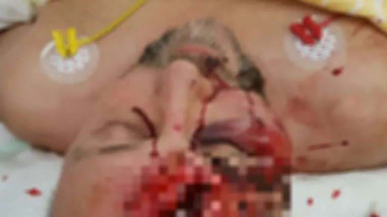 Desničarski političar bori se za život: 'Na ulici su ga palicama pretukli skoro do smrti'