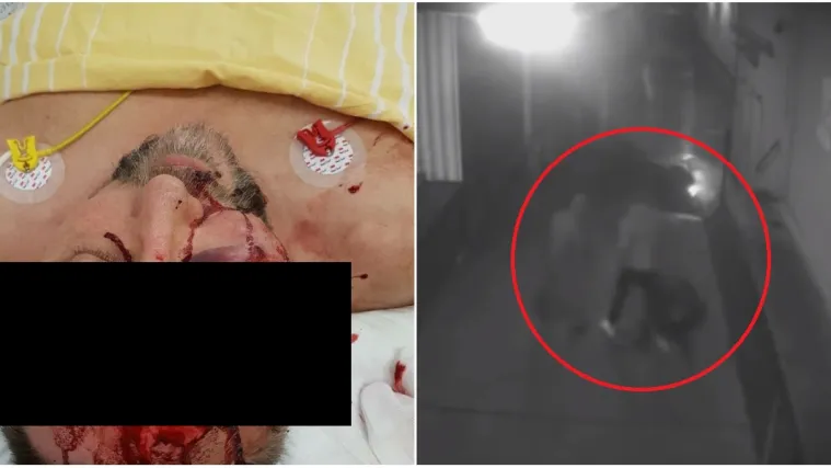 Objavljena snimka napada na političara: Jedan detalj ne podudara se s njegovom pričom