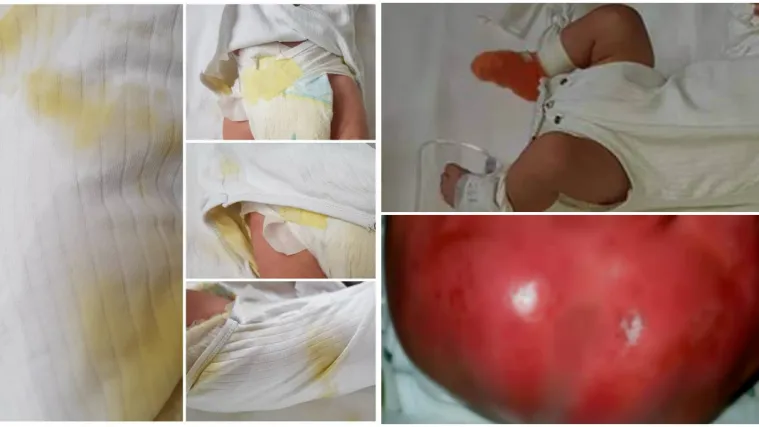 Fotografije beba &scaron;okirale javnost: 'Dijelovi tijela su im žive rane'. Ravnateljica: 'Prijete nam smrću'