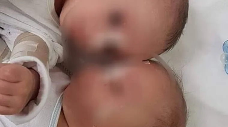 'Za žive rane na guzi djeteta nema opravdanja. Ovo je humana i profesionalna katastrofa!'