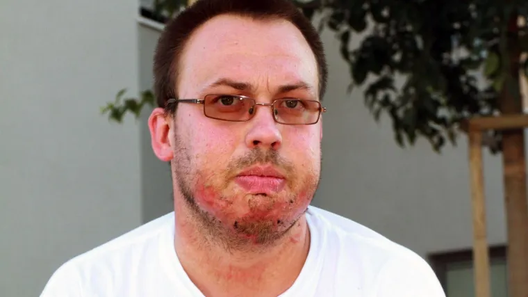 'Ne osjećam se dobro. I dalje sam tužan. Želim svoj život nazad. Želim živjeti kao svi moji vršnjaci'