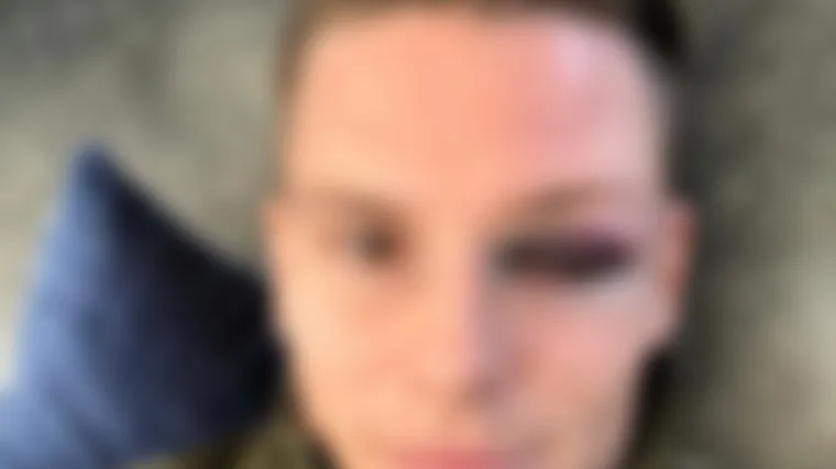 Au, ovo je moralo boljeti! Napadač Valencije pokazao unakaženo lice nakon derbija s Barcelonom