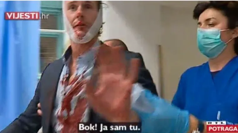 Pijani &Scaron;veđanin krvave glave napravio show u Vinogradskoj, liječnici ga morali smirivati, zvali i za&scaron;titare