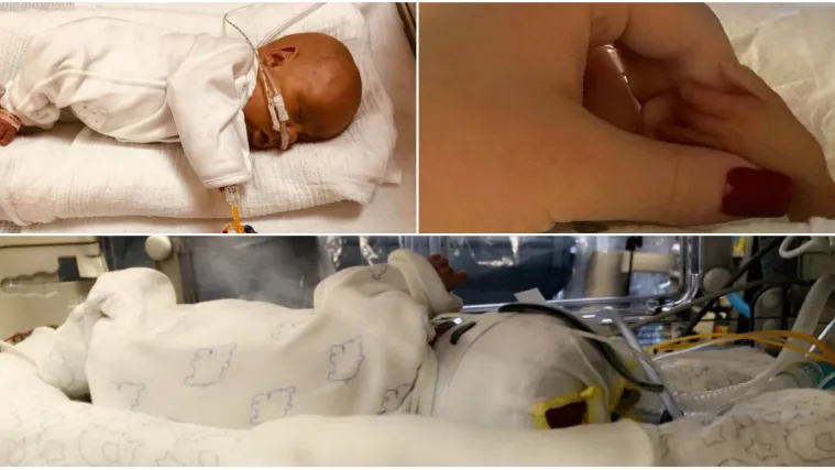 Rođen tri mjeseca ranije pa je pet puta pobijedio smrt: 'Bili smo uvjereni da će umrijeti'