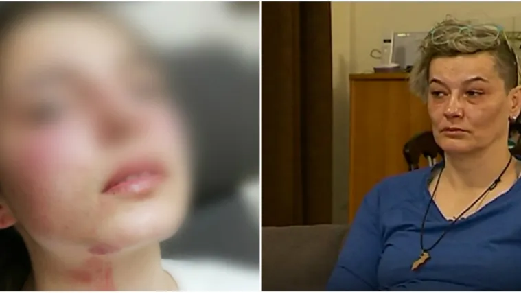 &Scaron;okantno: 'Potrgao joj je majicu, bila je polugola na cesti, s njenom glavom otrgnuo je letvicu s ograde'