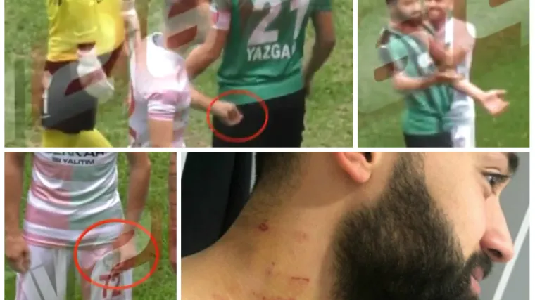 Igrač na travnjak u&scaron;ao sa britvom i razrezao suparnika, potom je krenuo i na njegov vrat