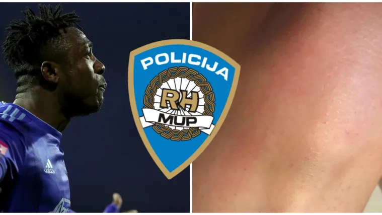 Pokazala modrice i poručila Iyayiju: 'Ne želim novac od monstruma!' Evo &scaron;to na sve kaže policija