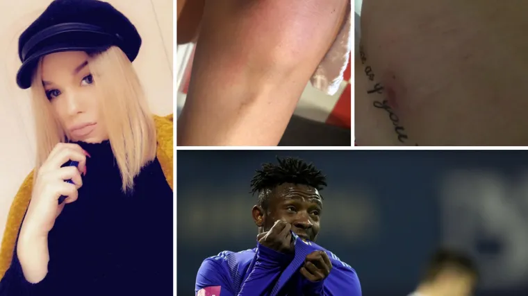 Još jedna žena optužuje Dinamovog Nigerijca: 'Bilo me strah, ne želim da me svi vrijeđaju kao Ivu'