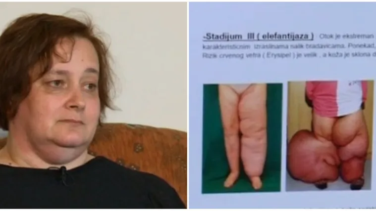 Nema adekvatnu liječničku skrb u Hrvatskoj: 'Vi&scaron;e nemamo vremena, a Ani je hitno potrebna pomoć'