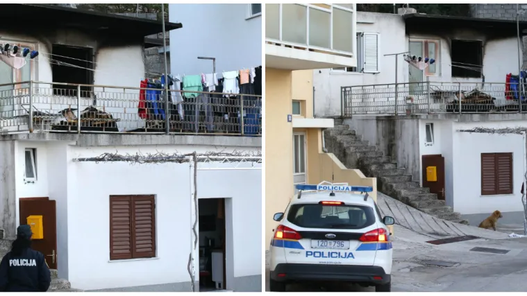 FOTO Opekotine &scaron;aka i nogu: Otac i sin stradali u požaru koji je planuo u obiteljskoj kući