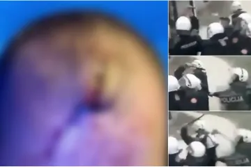 Pokušao doći do liječnika i dobio batine; strava nakon derbija